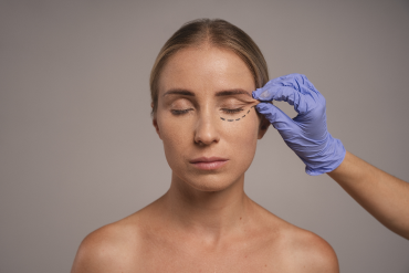 thumbnail_blog_blefaroplastia_370x246.webp