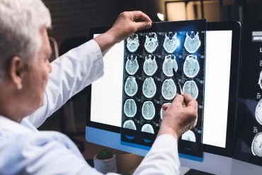 thumbnail_blog_exames_de_imagem_370x245_0.webp