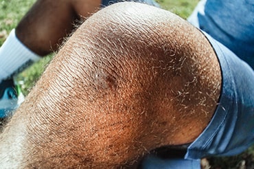 joelho-thumb.jpg