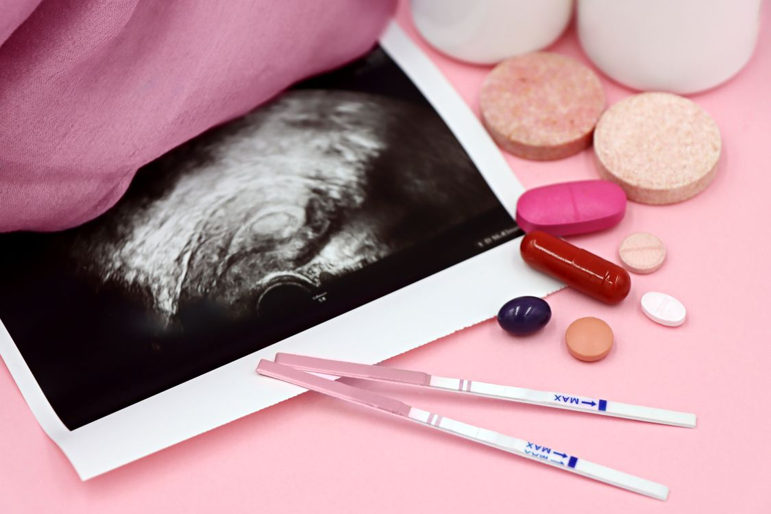 foto testes de gravidez e um ultrassom com suplementos em um fundo rosa