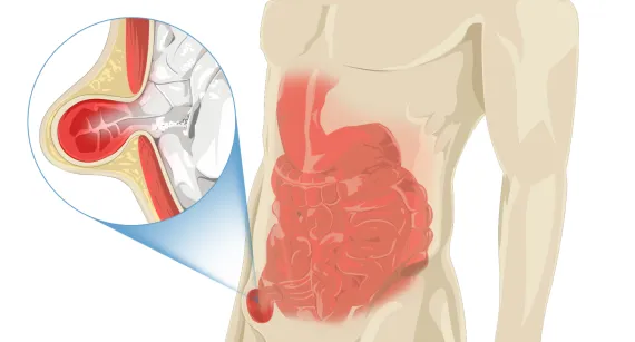 Coloproctologia