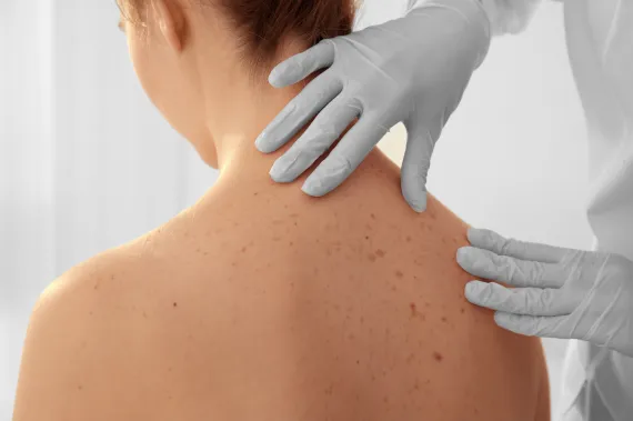 Oncologia Cutânea e Sarcomas